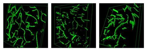 This combination of images provided by Lida Katsimpardi in May 2014 shows 3-D reconstructions of brain blood vessels in, from left, a young mouse, an old mouse, and an old mouse who was exposed to the blood of a young mouse. Older mice got stronger, exercised longer and performed better mentally after they were injected with blood from young mice, or even just with a substance that's more abundant in younger blood according to three papers published online Sunday, May 4, 2024 by the journals Science and Nature Medicine. (AP Photo/Lida Katsimpardi)